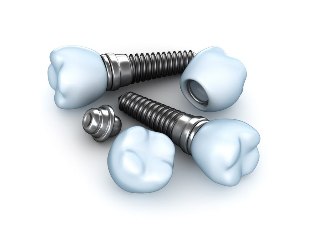 Dental Implants | Cedar Creek Dental